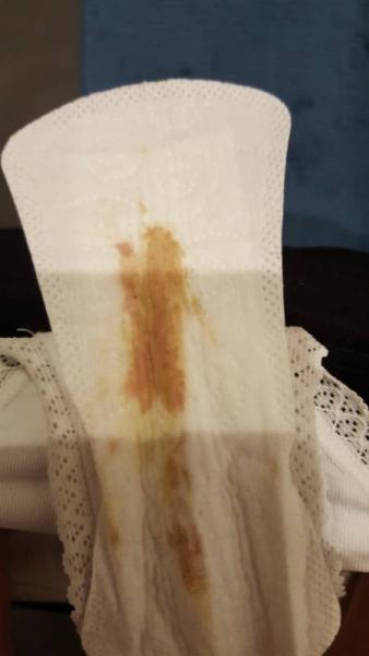 Bild zu Blut in der Slipeinlage - Zeichnungsblutung? - Forum für November - Mamis