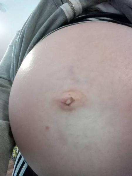 Bild zu Bauchnabel - Forum für November - Mamis