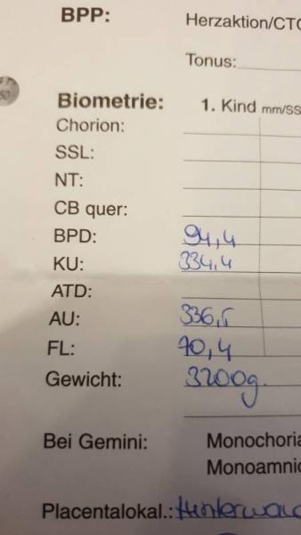 Bild zu Mimimi-post 38+3 - Forum für November - Mamis
