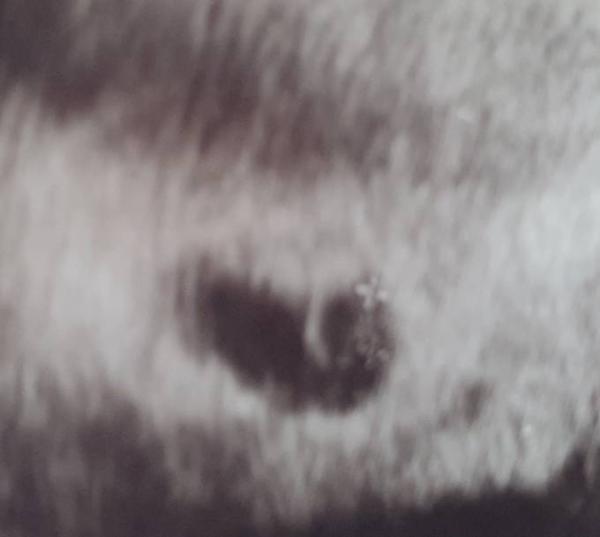 Bild zu Erstes US - Forum für November - Mamis