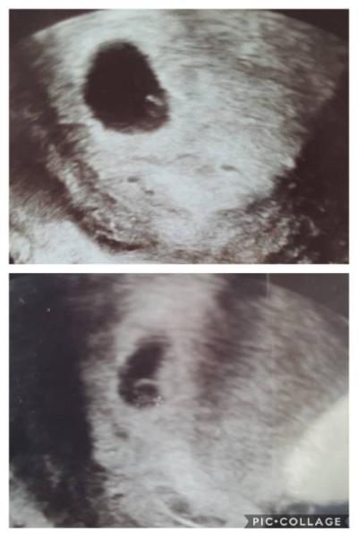 Bild zu Blutungen - Forum für November - Mamis