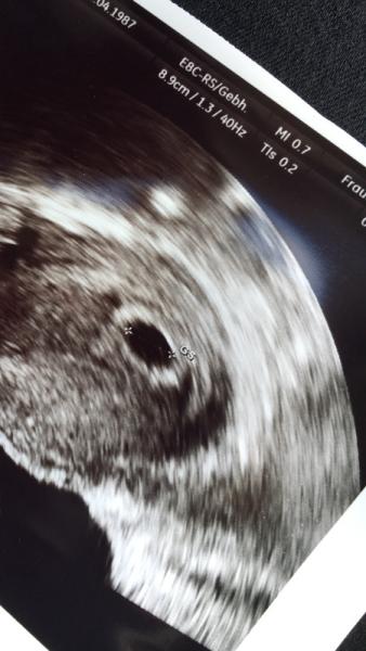Bild zu Erster FA Termin - Forum für November - Mamis