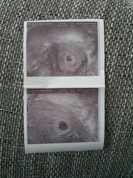 Bild zu Verzweifelt:( - Forum für November - Mamis