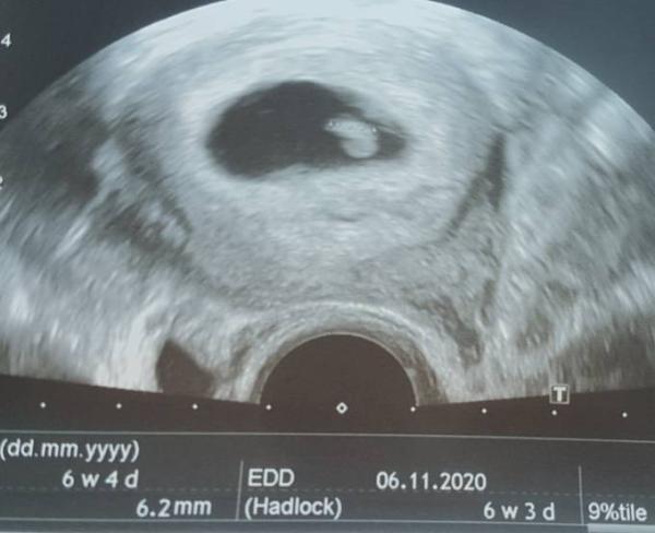 Bild zu Erleichtert - Forum für November - Mamis