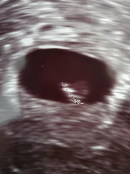 Bild zu Unser Herz schlägt auch - Forum für November - Mamis