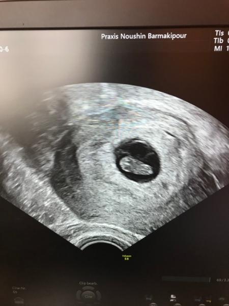 Bild zu Ich bin raus - Forum für November - Mamis