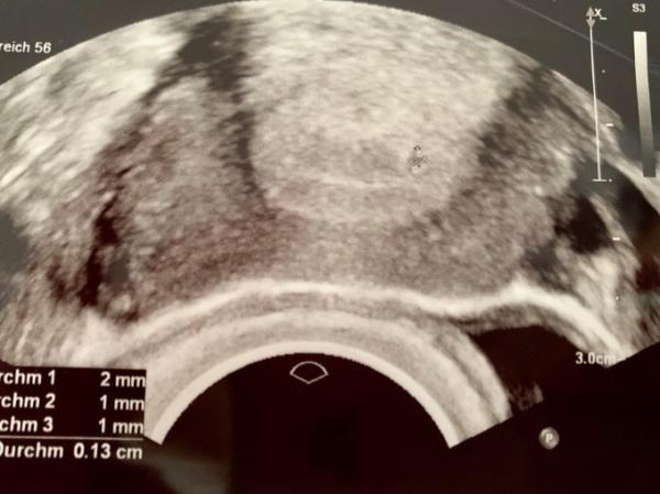 Bild zu US von 4+4 - Forum für November - Mamis