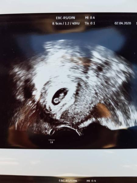 Bild zu Das Herz schlägt - Forum für November - Mamis