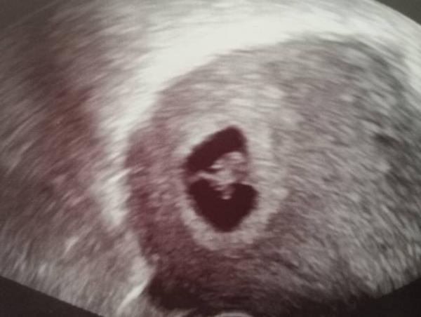Bild zu Das Herz schlägt - Forum für November - Mamis