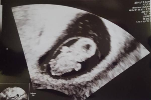 Bild zu Möchte auch mitfahren - Forum für November - Mamis