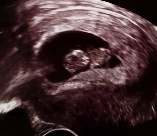 Bild zu 2. Termin - Forum für November - Mamis
