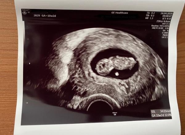 Bild zu Heute 2.Termin - neue Fotos - jetzt Hebamme suchen! - Forum für November - Mamis