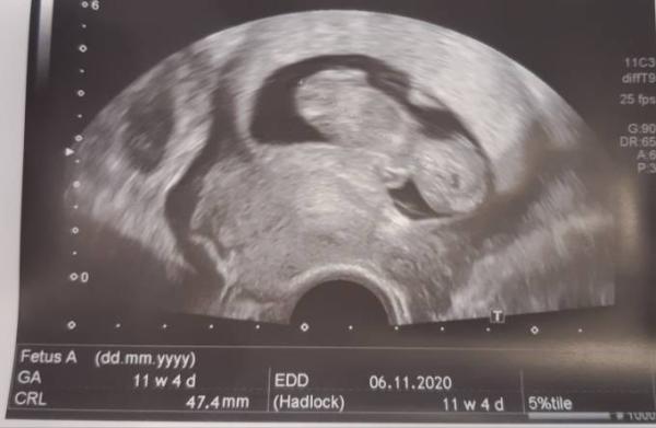 Bild zu Nächster Termin geschafft - Forum für November - Mamis