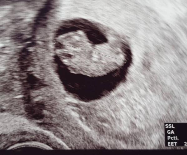 Bild zu Auch zurück vom FA - Forum für November - Mamis