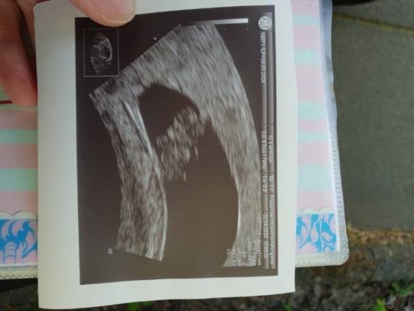 Bild zu Zurück vom Termin und verunsichert - Forum für November - Mamis