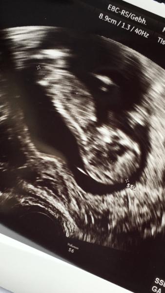Bild zu Zurück von FA - Forum für November - Mamis
