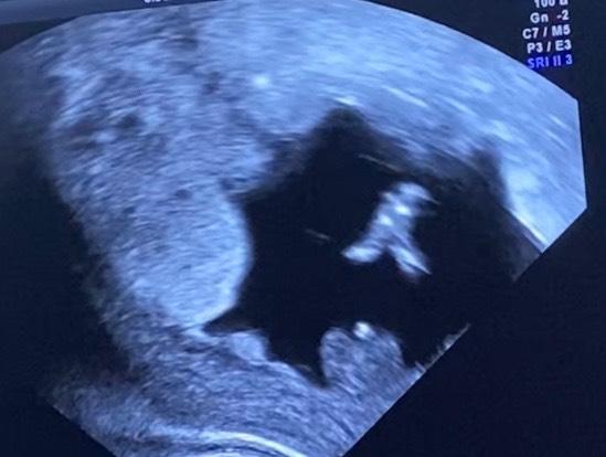 Bild zu Junge oder Mädchen - Forum für November - Mamis