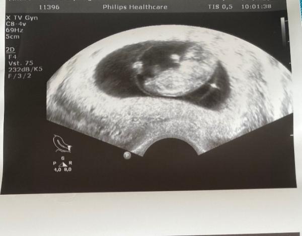 Bild zu Nub- Theorie - Forum für November - Mamis