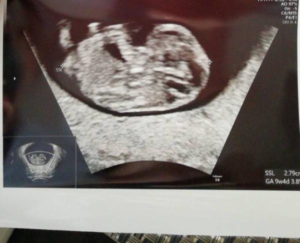 Bild zu Das Ersttrimesterscreening ist geschafft! - Forum für November - Mamis