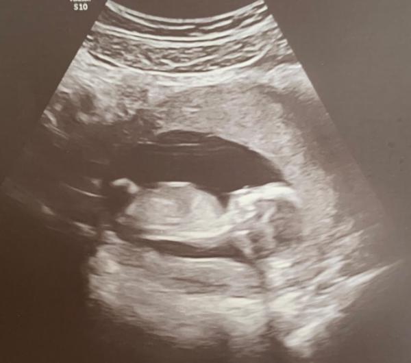 Bild zu Freude - Forum für November - Mamis