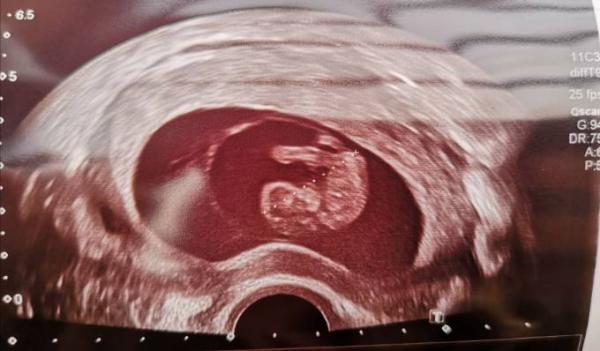 Bild zu Hallo in die Runde! - Forum für November - Mamis