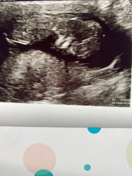Bild zu Vorfreude pur - Forum für November - Mamis