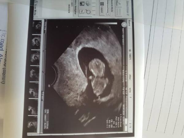 Bild zu Zurück vom Termin - Forum für November - Mamis
