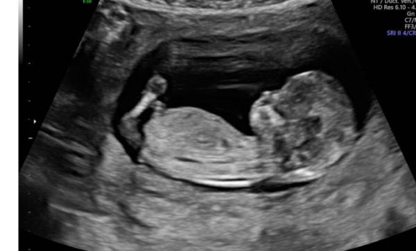 Bild zu auch von mir gute Neuigkeiten - Forum für November - Mamis