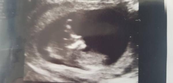 Bild zu Erleichterung und Outing - Forum für November - Mamis
