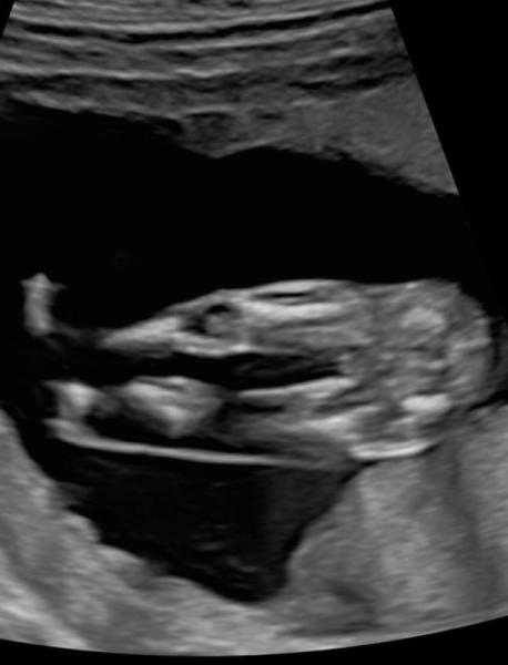 Bild zu Was seht ihr? - Forum für November - Mamis