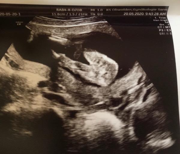 Bild zu Was erkennt ihr? - Forum für November - Mamis
