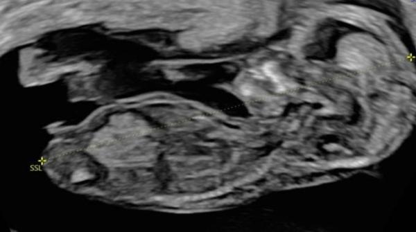 Bild zu Welches Geschlecht? - Forum für November - Mamis