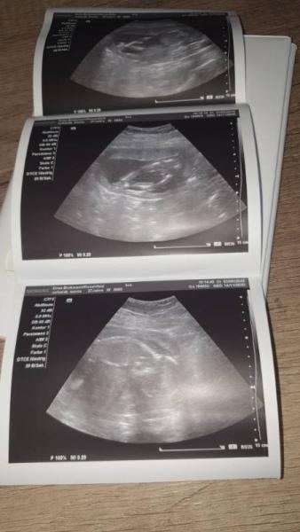 Bild zu Endlich heute wieder ein Babydate gehabt ♥️ - Forum für November - Mamis