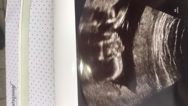 Bild zu Halbzeit und FA Termin - Forum für November - Mamis