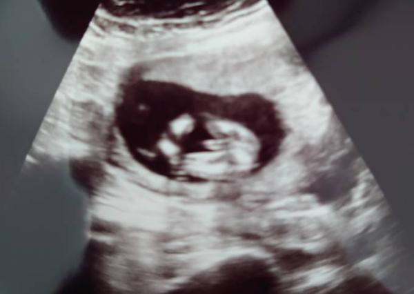 Bild zu Eindeutig Junge oder doch Mädchen? - Forum für November - Mamis