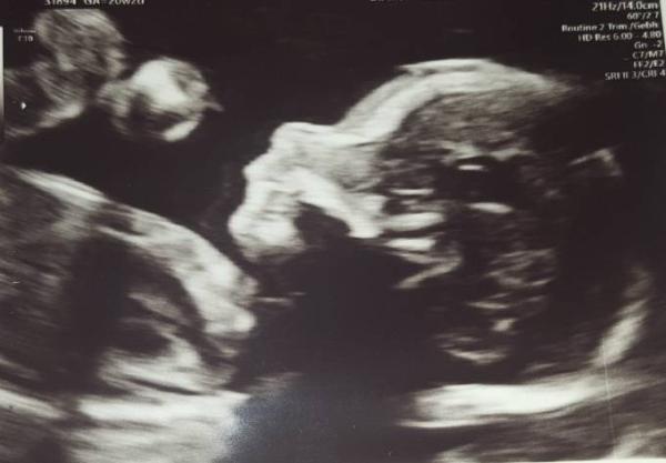 Bild zu Feindiagnostik - Forum für November - Mamis