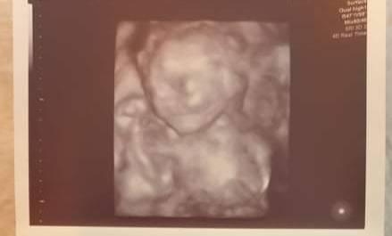 Bild zu 2. Ultraschall - Forum für November - Mamis