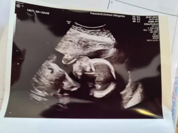 Bild zu Zurück vom Termin :) - Forum für November - Mamis