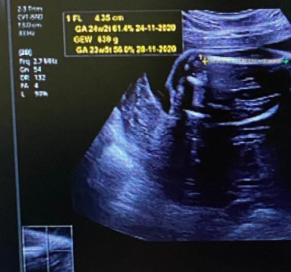Bild zu Sorge um Gewicht des Babys - Forum für November - Mamis