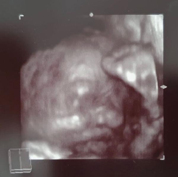 Bild zu Vorfreude wächst - Forum für November - Mamis