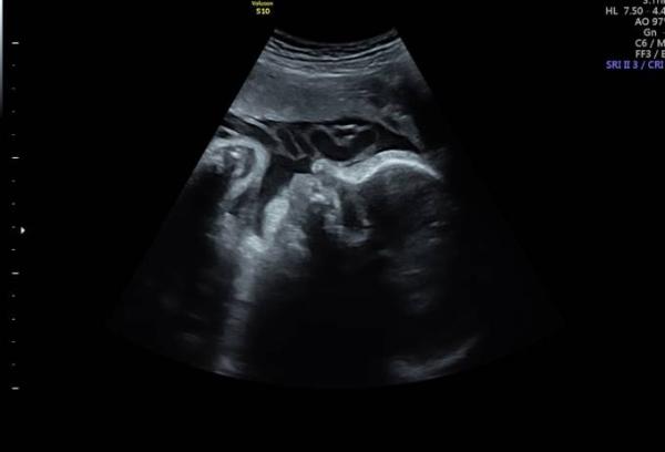 Bild zu Volle Woche... - Forum für November - Mamis