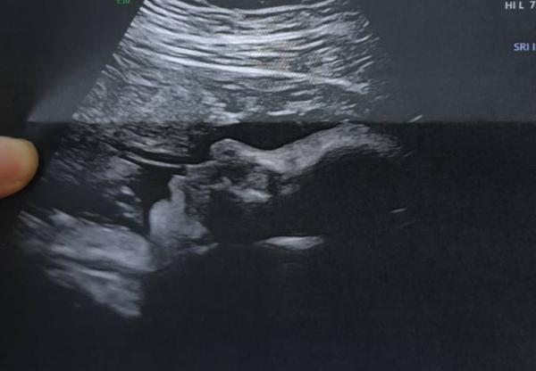 Bild zu Zurück vom Termin im Krankenhaus - Forum für November - Mamis