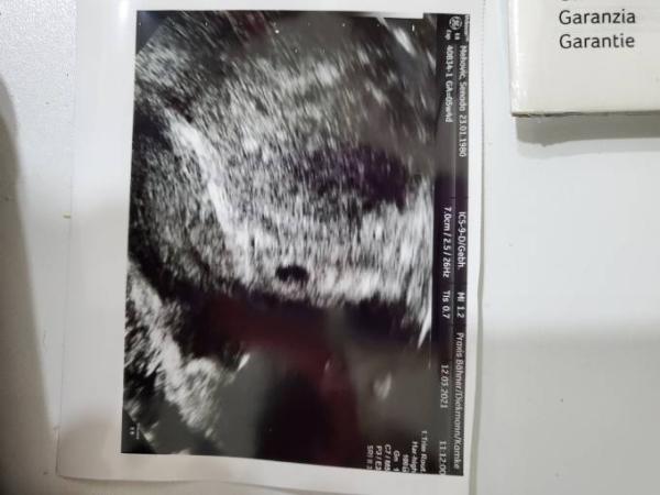 Bild zu Erste US Untersuchung - Forum für November - Mamis
