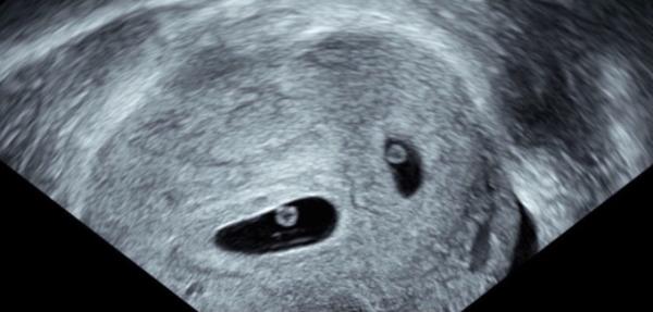 Bild zu Sprachlos! Damit hätte ich nicht gerechnet - Forum für November - Mamis