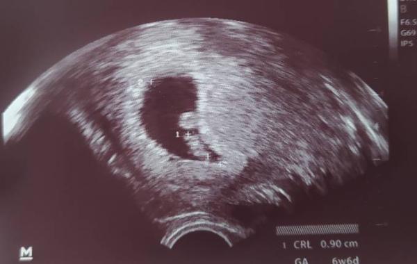 Bild zu Erster FA Termin 😊 - Forum für November - Mamis