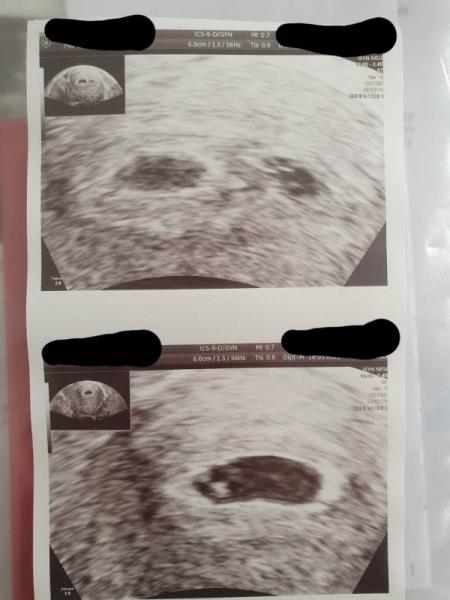 Bild zu Ich weiß noch nicht so recht.... - Forum für November - Mamis