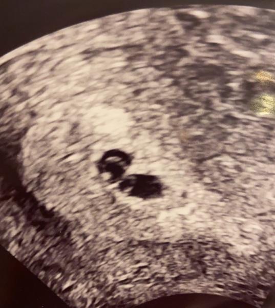 Bild zu Doppeltes Glück?! - Forum für November - Mamis