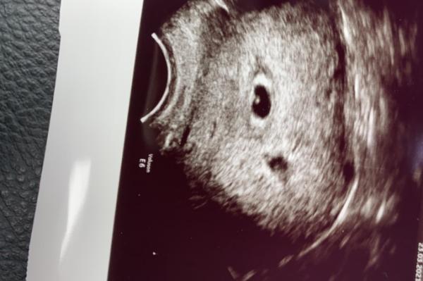 Bild zu Zwillinge? - Forum für November - Mamis