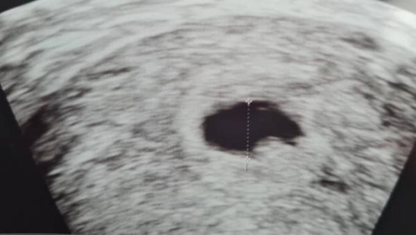 Bild zu 6+2 besorgt - Forum für November - Mamis