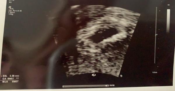 Bild zu Ich bin zurück - Forum für November - Mamis